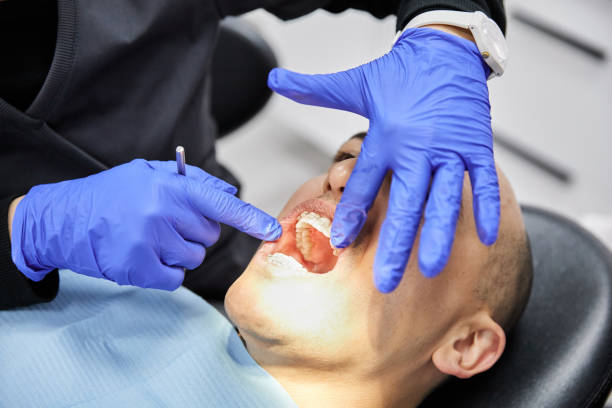 Best Emergency Dental Care for Broken or Chipped Teeth in Concordia, NJ